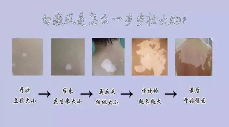白癜风专科医院